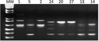 Intra-Discrete Typing Unit TcV Genetic Variability of Trypanosoma cruzi in Chronic Chagas' Disease Bolivian Immigrant Patients in Barcelona, Spain